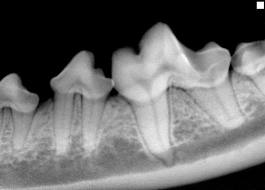 Dental X-ray